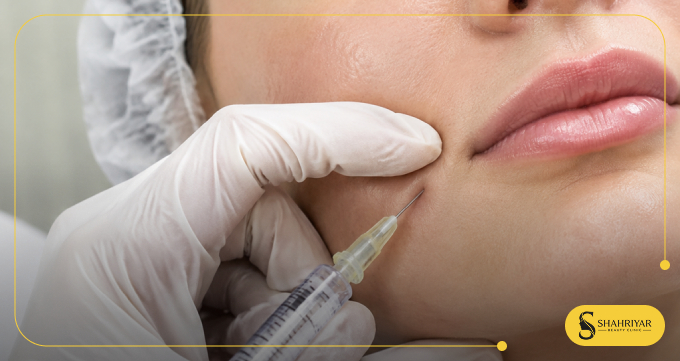 چه زمانی برای تزریق فیلر خط خنده اقدام کنیم؟