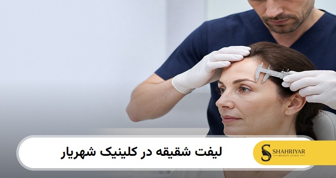 لیفت شقیقه