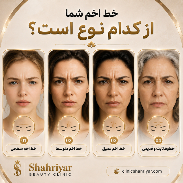 ویژگیهای بهترین کلینیک تزریق فیلر خط اخم در شهریار