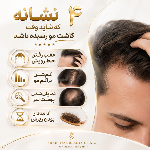 معیارهای انتخاب بهترین دکتر کاشت مو در شهریار