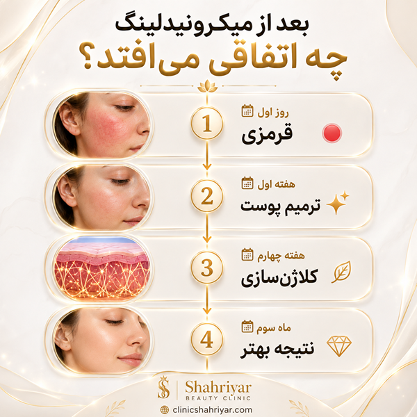 میکرونیدلینگ پوست چیست و چگونه باعث جوانسازی پوست میشود؟