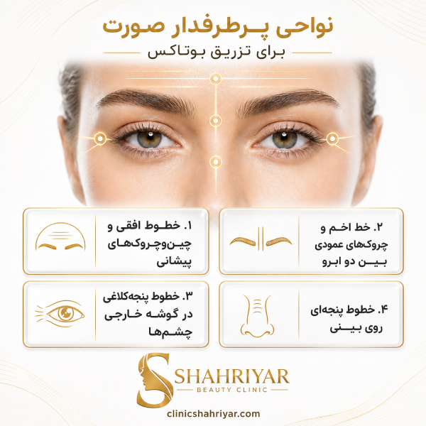 نواحی پرطرفدار صورت برای تزریق بوتاکس