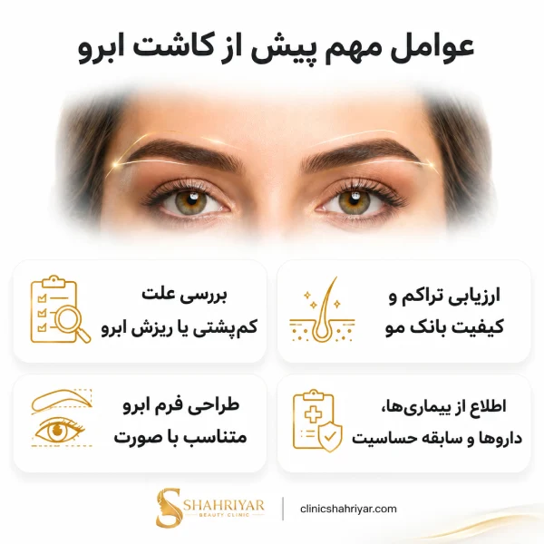 عوامل مهم پیش از کاشت مو