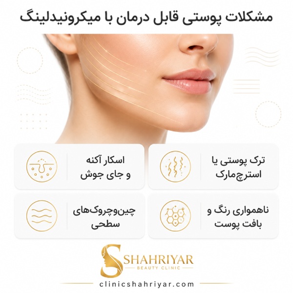 مشکلات پوستی قابل درمان با میکرونیدلینگ
