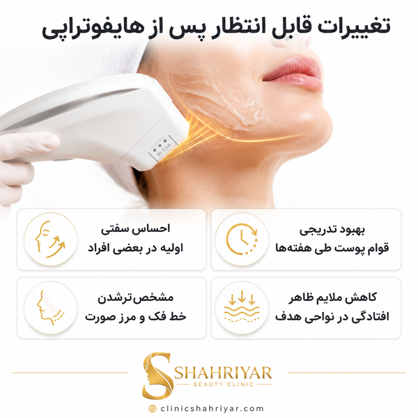 مزایای هایفوتراپی در کلینیک شهریار