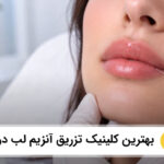 بهترین کلینیک تزریق آنزیم لب در فردیس