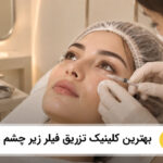 the-best-under-eye-filler-injection-clinic-in-fardis
